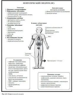 Синдром инфекций