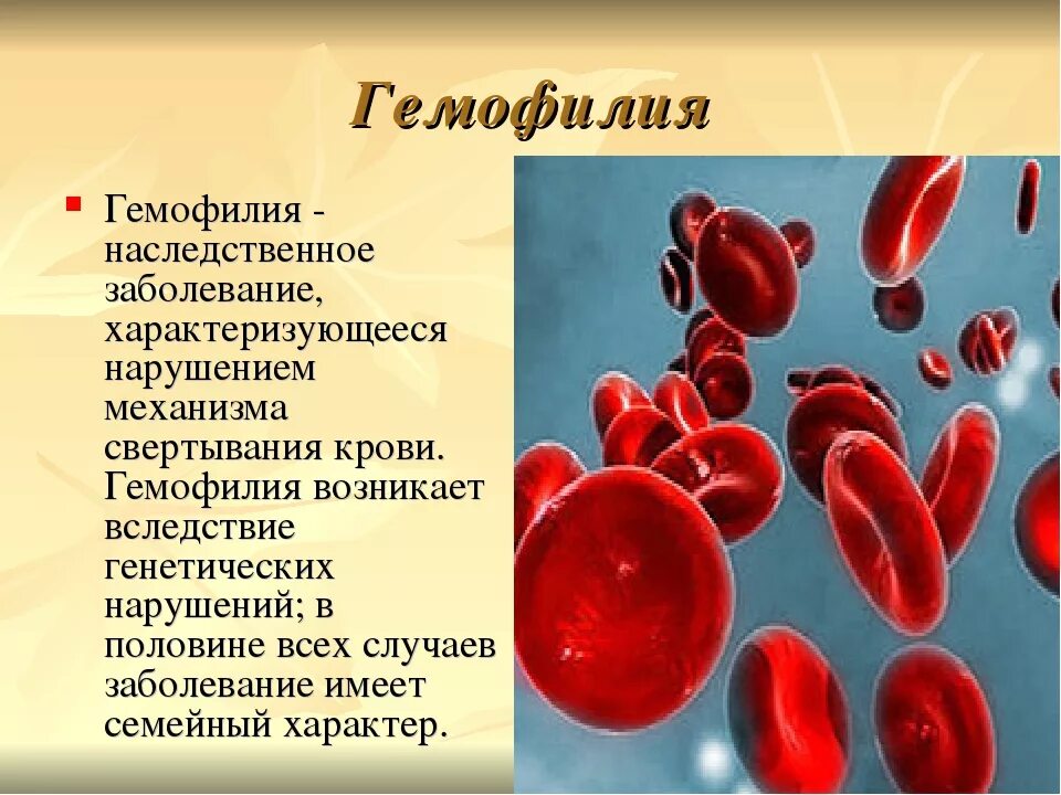 10 наследственных заболеваний. Гемофилия 8 класс биология. Наследственные заболевания по биологии. Презентация на тему наследственные заболевания.