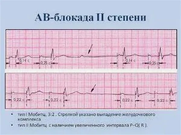 Лечебная блокада отзывы