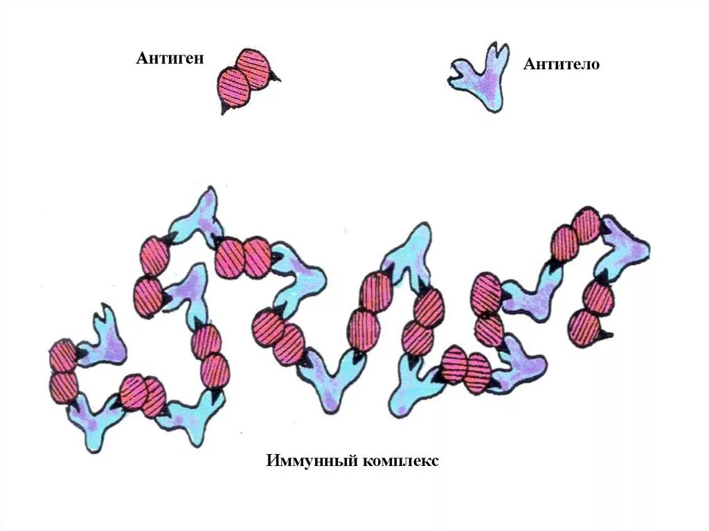 Антигены антитела иммунный ответ. Комплекс антиген—антитело (иммунный комплекс). Комплекс антиген антитело. Комплекс антиген антитело схема. Комплекс антиген антитело рисунок.