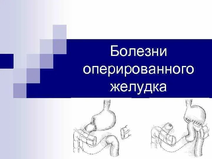 Хирургические заболевания желудка. Болезни оперированного желудка этиопатогенез. Классификация заболеваний оперированного желудка. Болезни оперированного желудка презентация. Болезни оперированного желудка этиология.