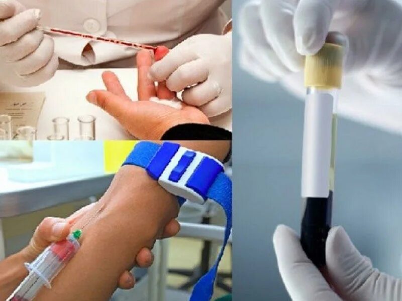 Техника взятия крови на ОАК. Взятие крови на исследование. Кровь после взятия анализа