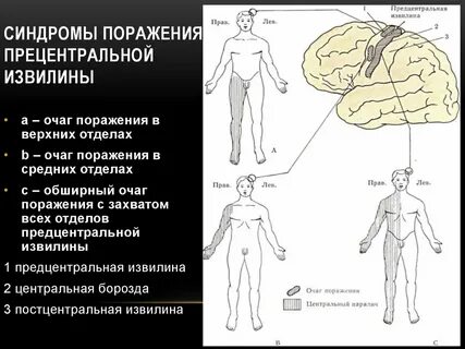 Какое поражение находится