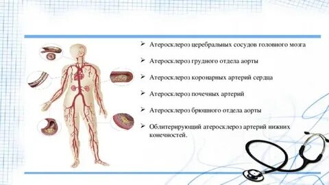 Церебральный атеросклероз это