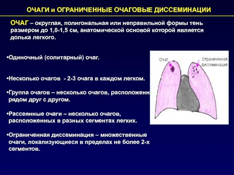 Очаги в нижней доле легкого. Рентгенологические синдромы легочной патологии. Синдром диссеминированного поражения легких. Очаги диссеминации в легких. Очаги и ограниченные очаговые диссеминации.