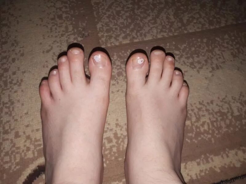 Длинные пальцы ног женщин. Длинные пальцы на ногах у девушек. Палец на ноге длиннее большого. Длинные пальцы на ногп.