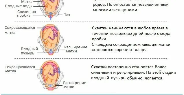 Сколько выходит пробка. Признаки начала родов. слизистая пробка отходит у первородящих. пробка перед родами у первородящих. пробка перед родами у повторнородящих.