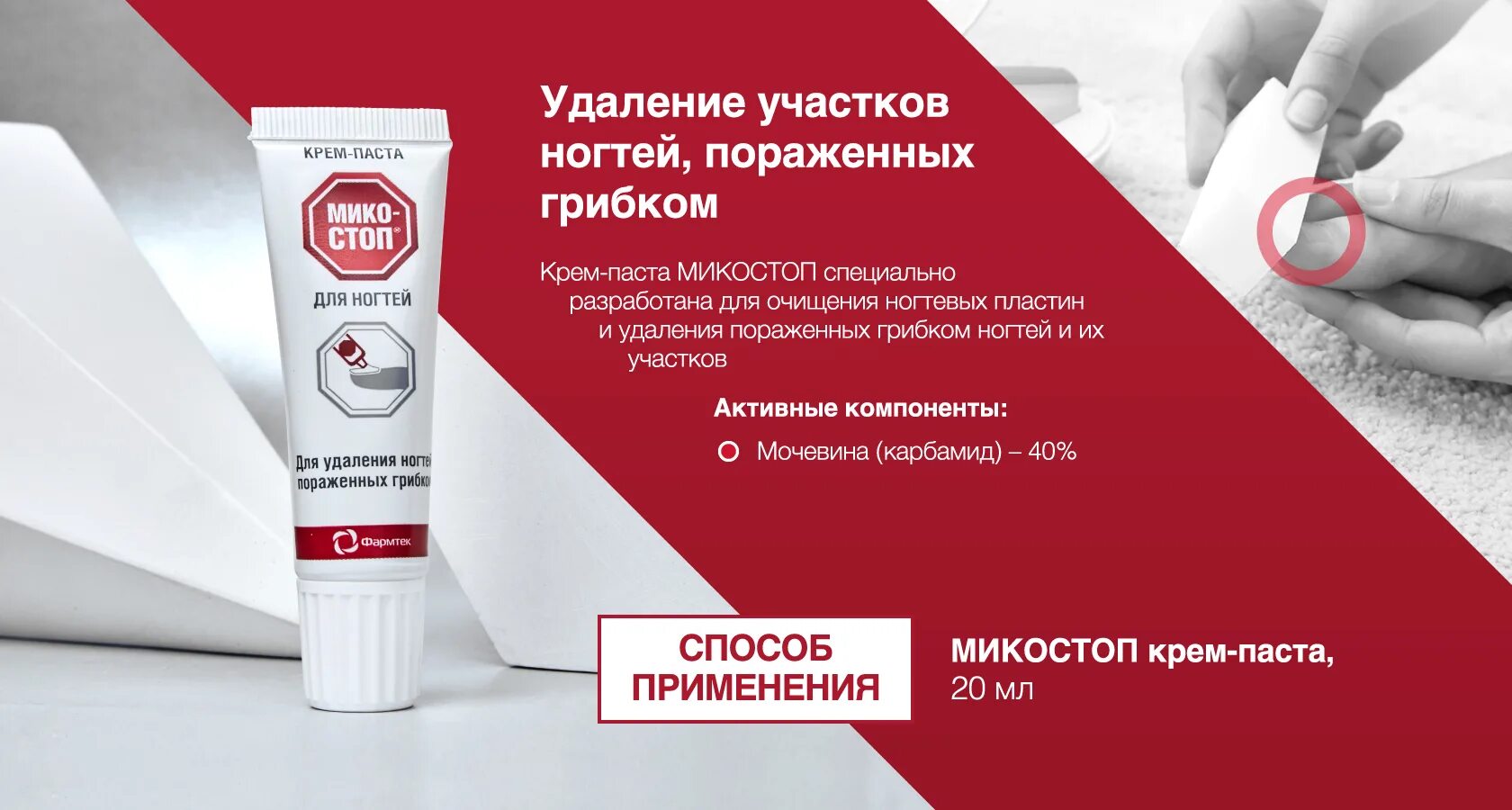Мазь для удаления ногтя пораженного грибком. Крем микостоп для ногтей поражённых грибком. Грибок ногтей крем для удаления ногтей. Грибок ногтей крем для удаления ногтей. Средство для удаления ногтя пораженного грибком.