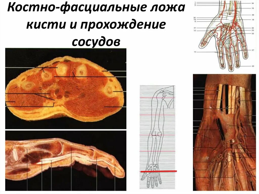 Поперечный распил стопы схема. Фасциальные ложа кисти. Фасциальные ложа ладони. Срезы кисти. Поперечный распил кисти схема.