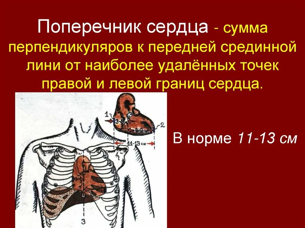 Норма форма сердца. Поперечник относительной тупости в норме. Поперечник относительной сердечной тупости в норме. Размеры поперечника относительной тупости сердца. Длинник и поперечник сердца.