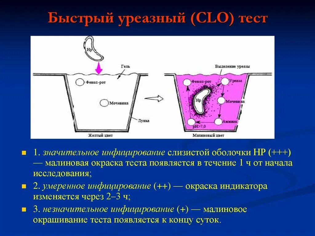 Уреазный тест что значит. Уреазный тест. Быстрый уреазный. Уреазный экспресс тест. Уреазный дыхательный тест методика.