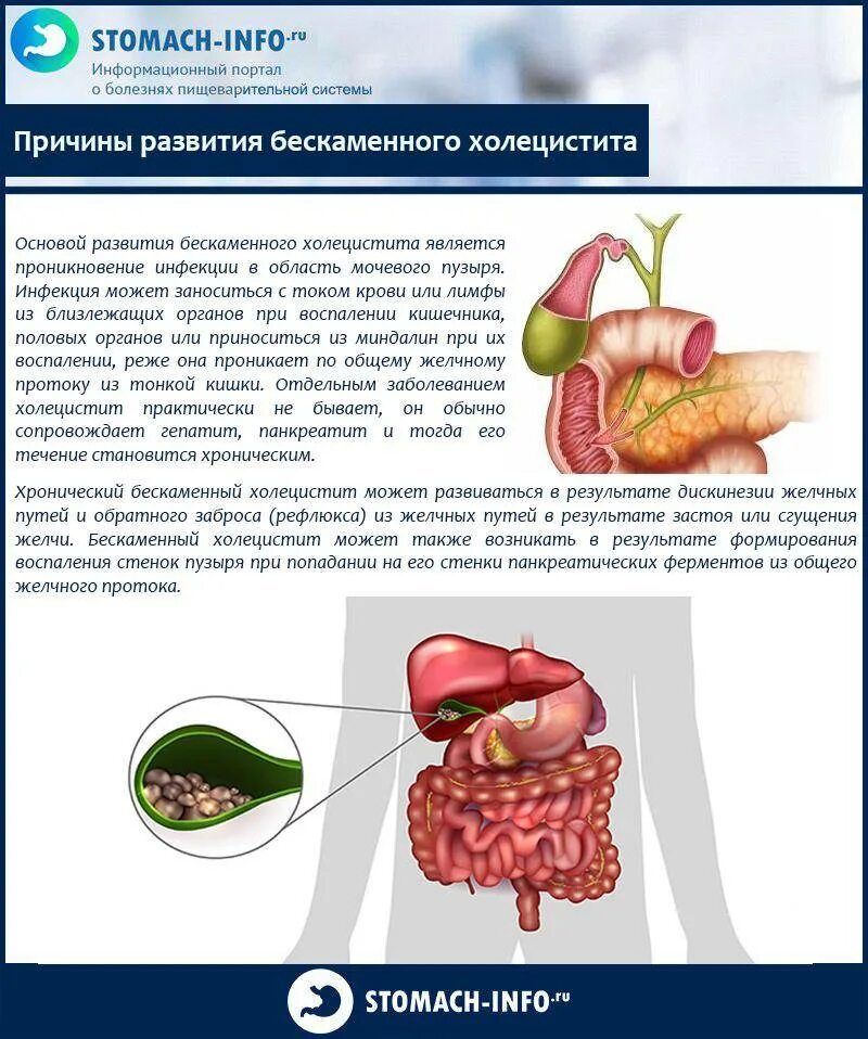 Холецистит причины заболевания. Холецистит желчнокаменная болезнь симптомы. Синдромы желчного пузыря симптомы. Холецистит воспаление желчного пузыря. Застойного желчного пузыря что это,хронического холецистита.