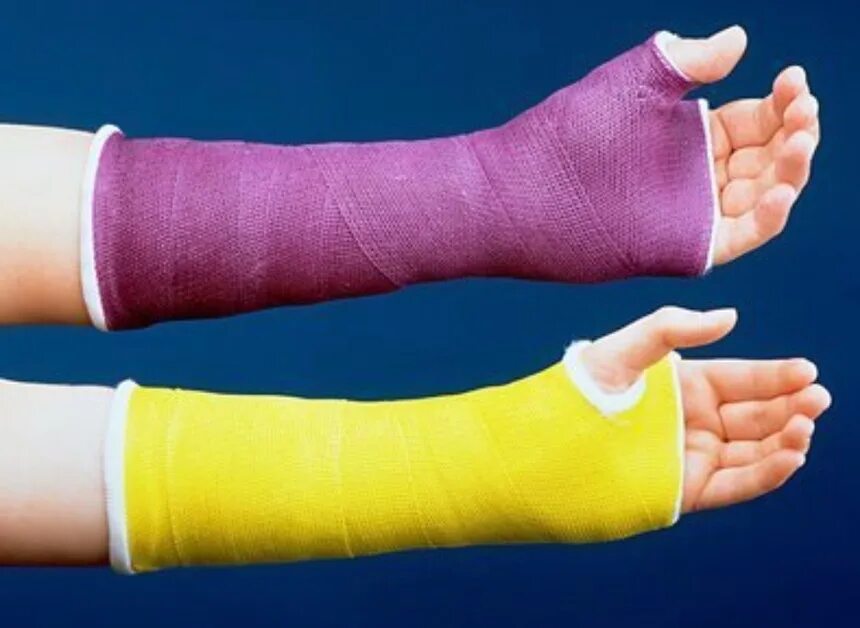 Гипс высокопрочный г-16. Лепнина гипсовая петергоф дворец. Тутор grafo. Гипс полификс. Тутор полификс.