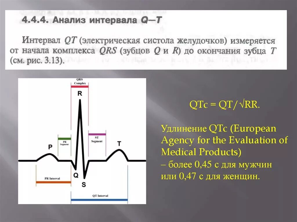 Удлиненное qt на экг. QTC норма ЭКГ. Отрицательный зубец р после QRS комплекса. Синдром удлиненного интервала qt. Qt QTC на ЭКГ норма.