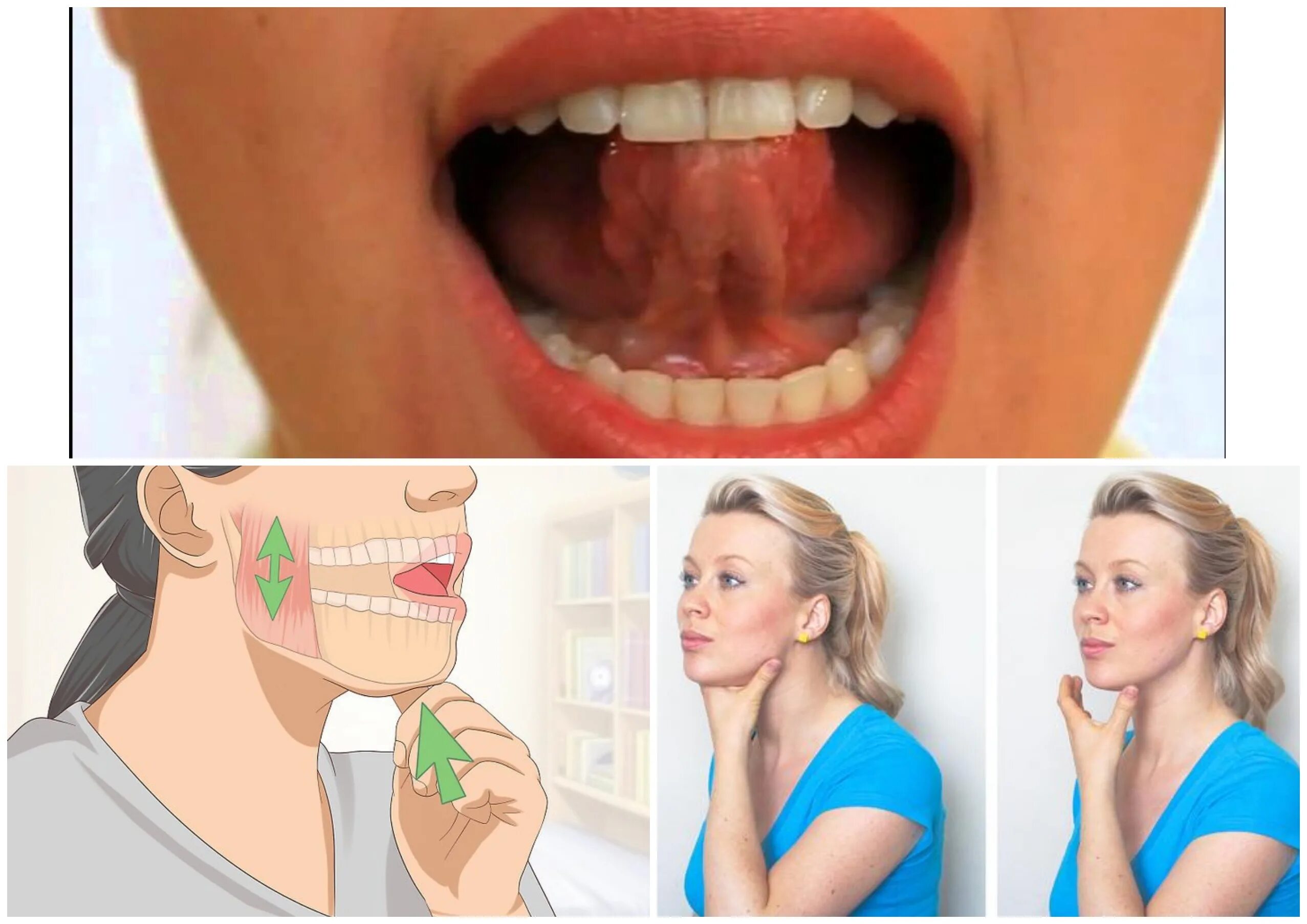 Щелкает челюсть при открытии рта что делать. Челюстью(дисфункция ВНЧС). Дисфункция жевательных мышц. Дисфункция нижнечелюстного сустава. Дисфункция челюстных мышц.