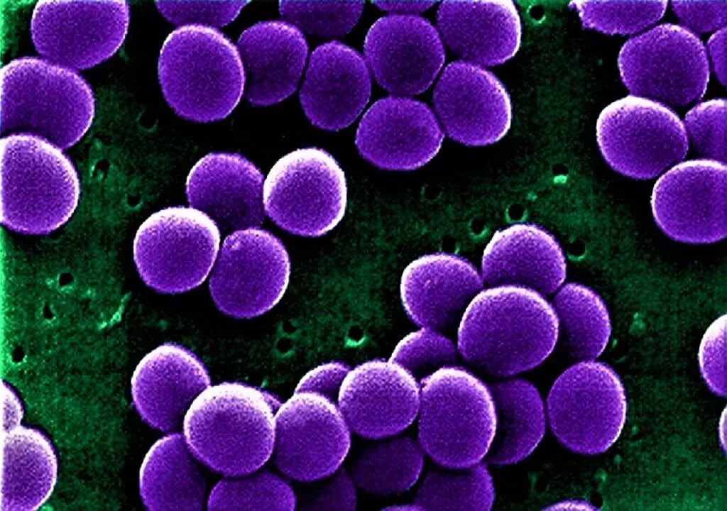 Staphylococcus aureus золотистый стафилококк. S. aureus золотистый стафилококк. Зеленящий стафилококк. Галофилы стафилококки. GRSA стафилококки.