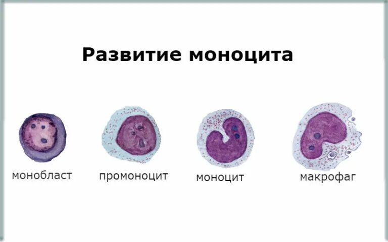 Много моноцитов это. Стадии развития моноцитов. этапы образования моноцитов. монобласт промоноцит моноцит. моноциты функции.