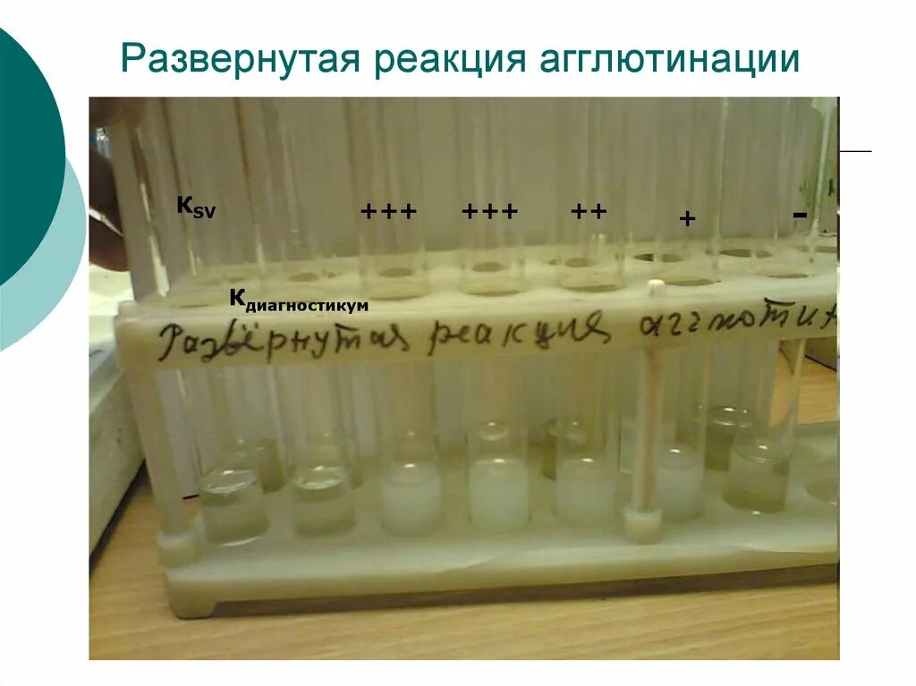 Развернутая реакция агглютинации. Реакция агглютинации видаля микробиология. учет реакции агглютинации в пробирках. реакция агглютинации микробиология. реакция агглютинации в пробирках микробиология.