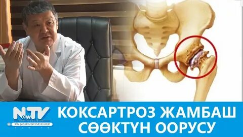 Сарык оорусу