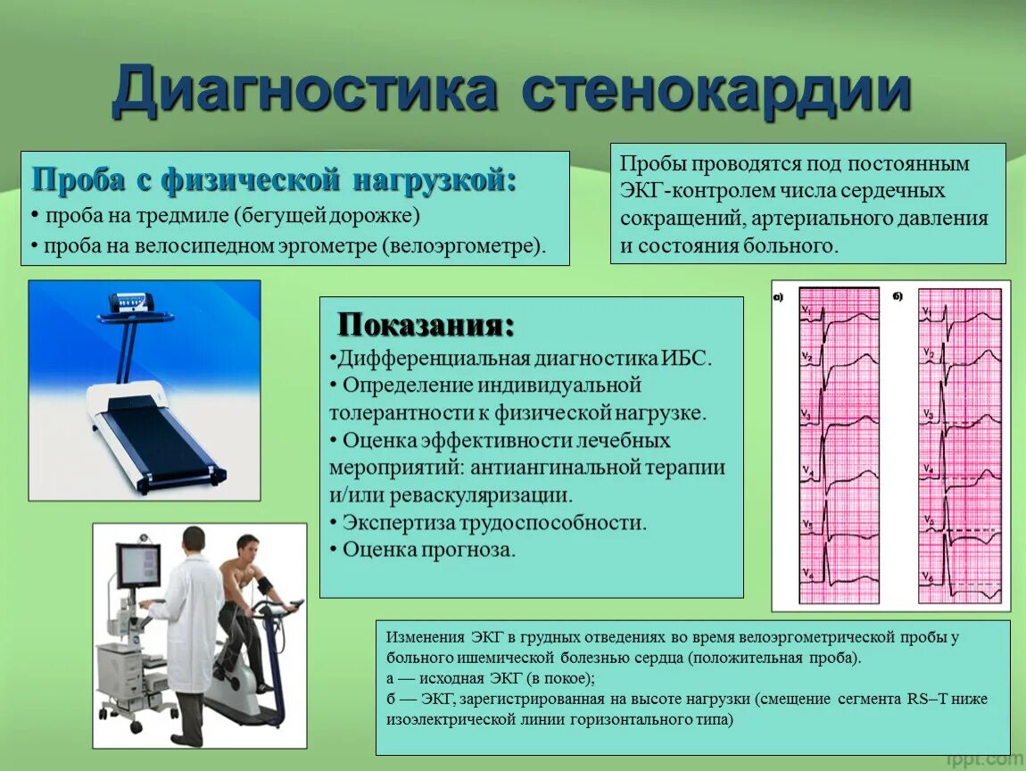 Проба с физической нагрузкой. Нагрузочные пробы при ИБС. Диагностика стенокардии. Нагрузочные пробы ЭКГ. Нагрузочное экг