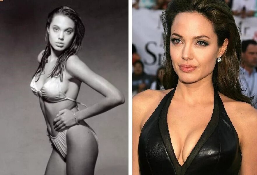 Angelina jolie nose job, Celebrity plastic surgery, Angelina jolie nose