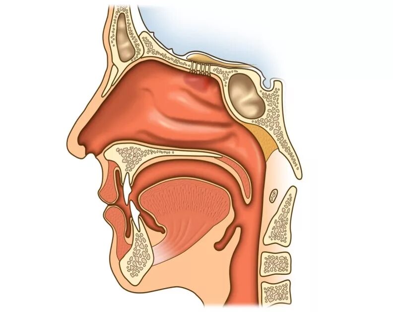 Носовой проход отделен от ротовой полости твердым. Строение носоглотки аденоиды. Анатомия носоглотки аденоиды. Носовая полость аденоиды. Анатомия ЛОР органов аденоиды.
