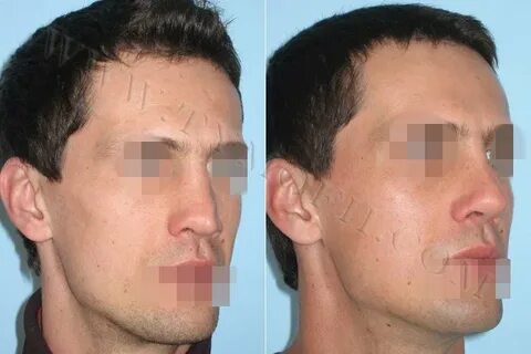 Не имел собственного лица