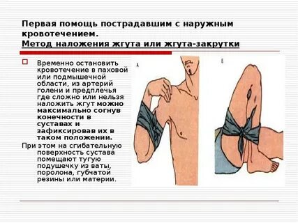 Повязкой наружные кровотечения