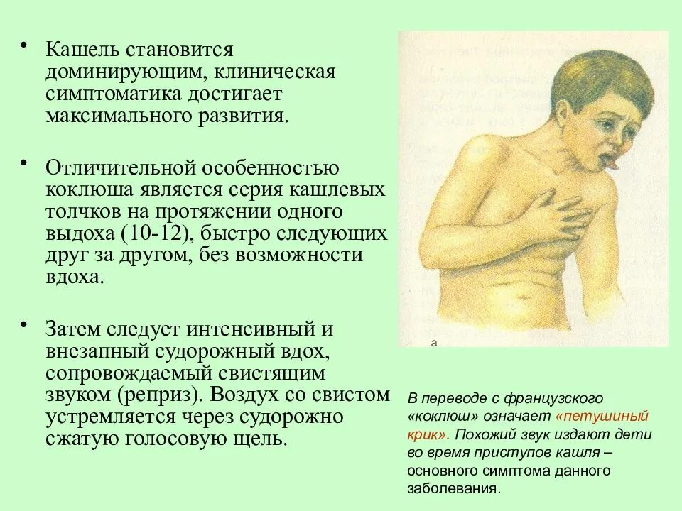 Как отличить кашель от коклюша у взрослых. Характеристика кашля при коклюше. спазматический кашель коклюша. характерный кашель при коклюше. приступ кашля при коклюше.