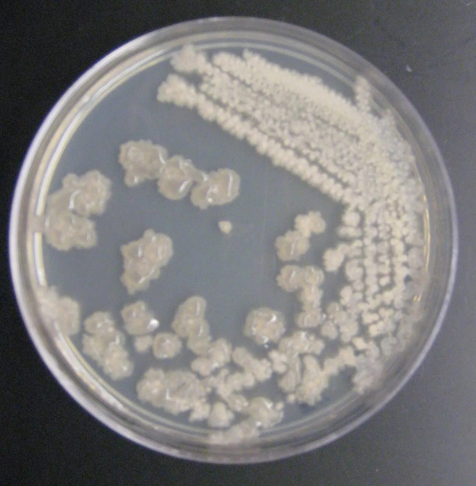 Bacillus subtilis что это. Bacillus subtilis колония. bacillus mesentericus колонии. bacillus subtilis на чашке петри. bacillus subtilis и bacillus licheniformis.