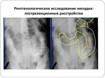Рентгенологическое исследование желудка