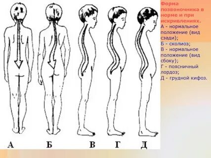 Виды положений рисунка