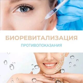 Биоревитализация биоревитализация лица можно