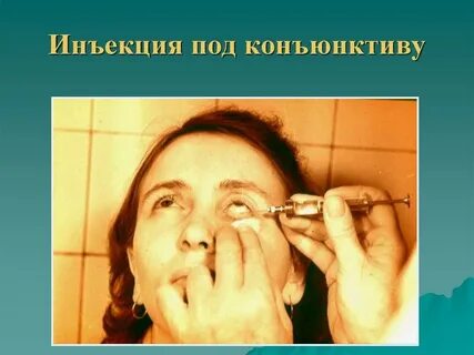 Глазные инъекции