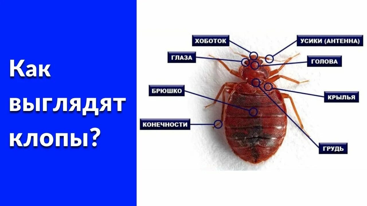 Как выглядят прыщи от клопов bed Sather Health