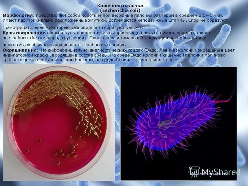 Клетка кишечной палочки. Кишечная палочка морфология. Кишечная палочка на среде Эндо. Кишечная палочка строение. Свойства кишечной палочки