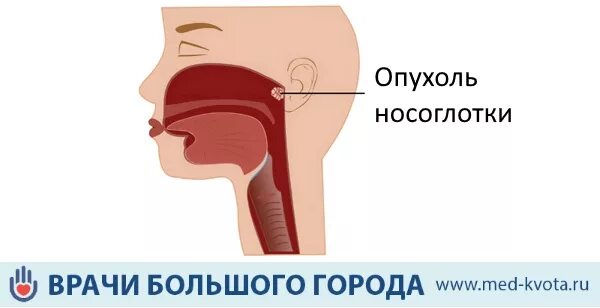 ● Здоровье носовой полости, пазух носа, гортани, миндалин ● Глубокое исцеление и