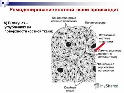 Межклеточного вещества в виде минерализованных пластинок