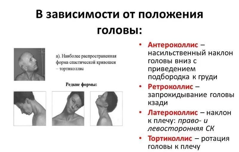 Изменение положения головы