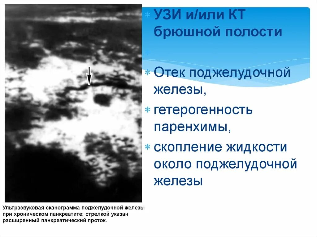 Поджелудочная железа липодистрофия что это. Поджелудочная железа липодистрофия что это. Псевдокиста поджелудочной железы кт. Поджелудочная железа липодистрофия что это. Липоматоз поджелудочной железы.