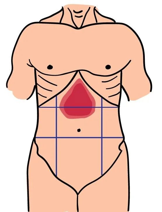 Средняя часть живота. Болит верх живота. Локализация боли в животе в картинках. Верхняя часть живота. Болит живот сверху.