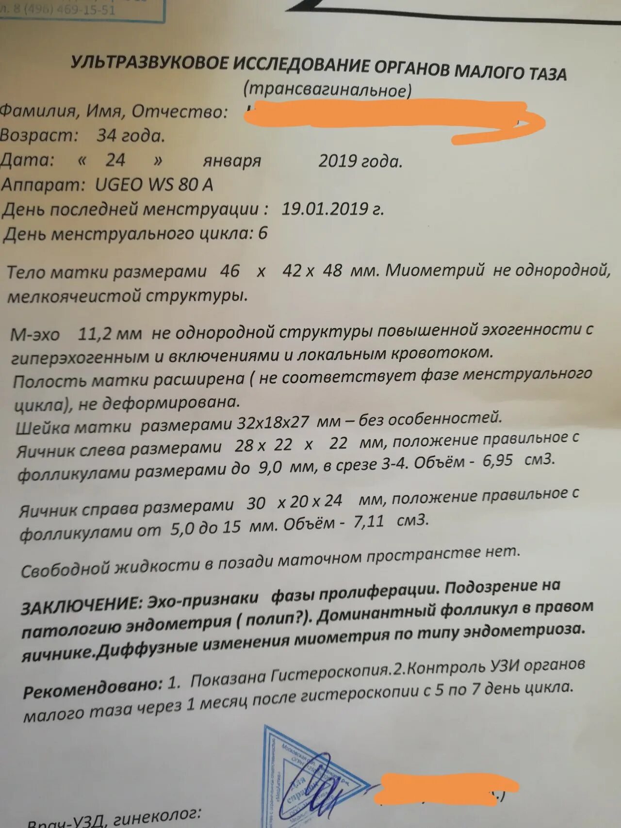 Узи вмс. Результаты узи. спираль узи протокол. вмс узи заключение. вмс на узи протокол.