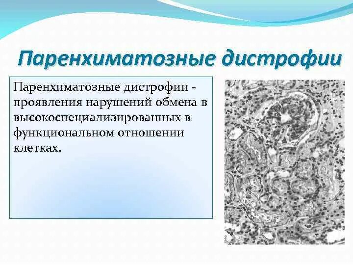 Паренхиматозные углеводные дистрофии. Паренхиматозные дистрофии. Паренхиматозные белковые дистрофии. Паренхиматозные дистрофии проявления. Паренхиматозные наследственные дистрофии.