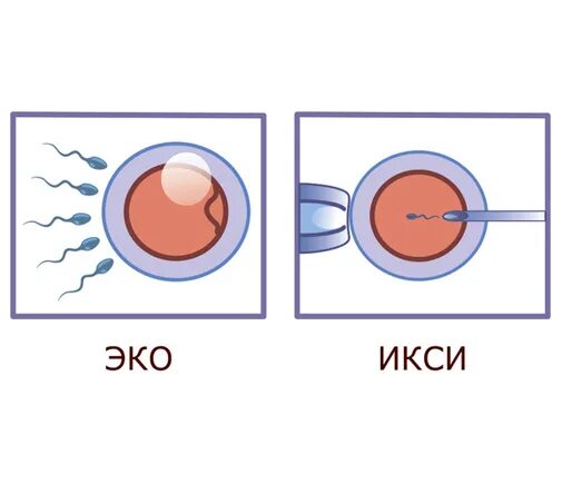 Эко ИКСИ. Эко или ИКСИ. ИКСИ оплодотворение что это. Эко и ИКСИ разница.