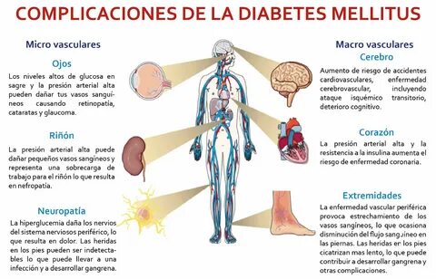 Que es la