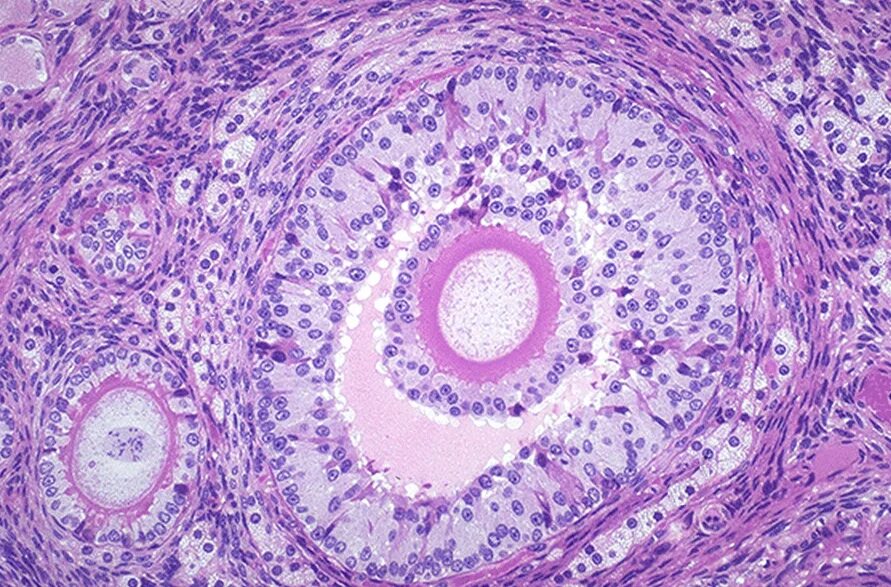 Что показала гистология замершей. Secondary follicle histology. желтое тело гистология препарат. киста желтого тела гистология.