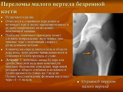 Ребенок вертится как пишется