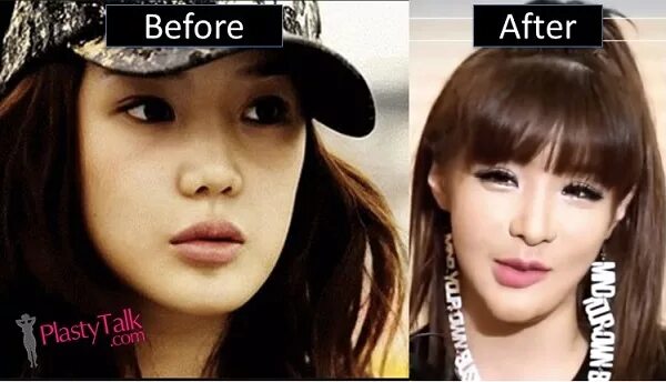 Park Bom Plastic Surgery