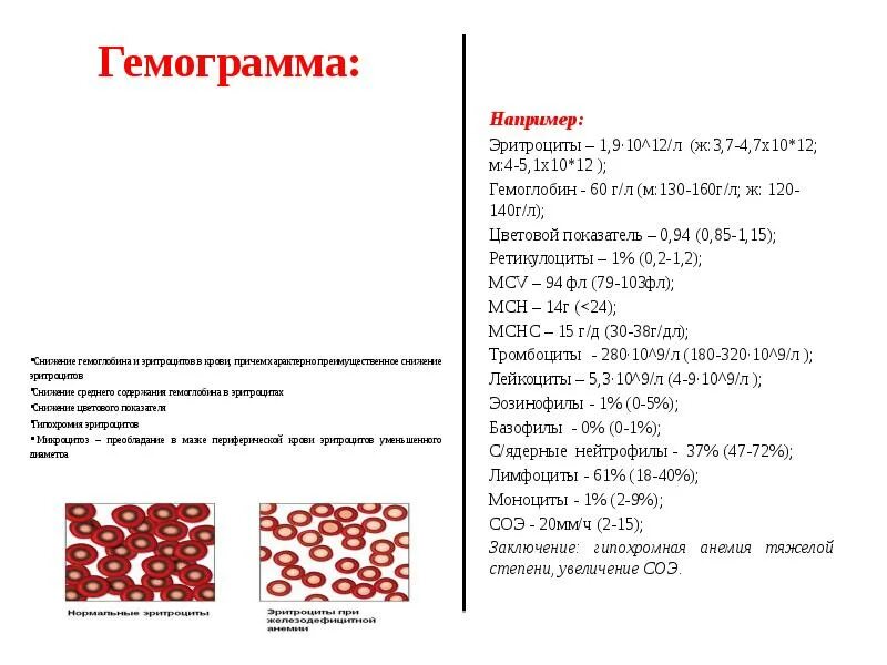 Понижен гемоглобин в эритроцитах что это. Снижение эритроцитов. гемограмма гемоглобин. пониженный гемоглобин и эритроциты. соэ при железодефицитной анемии.