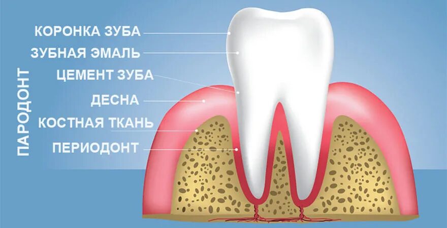 Пародонтит периодонтит пародонтоз. Альвеолярная десна